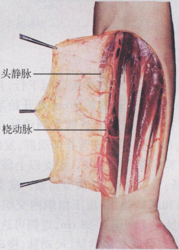 手术前用超声多普勒探测血管情况,以排除血管解剖变异和病变;标记出